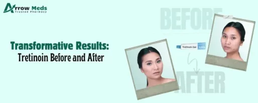 Transformative Results_ Tretinoin Before and After