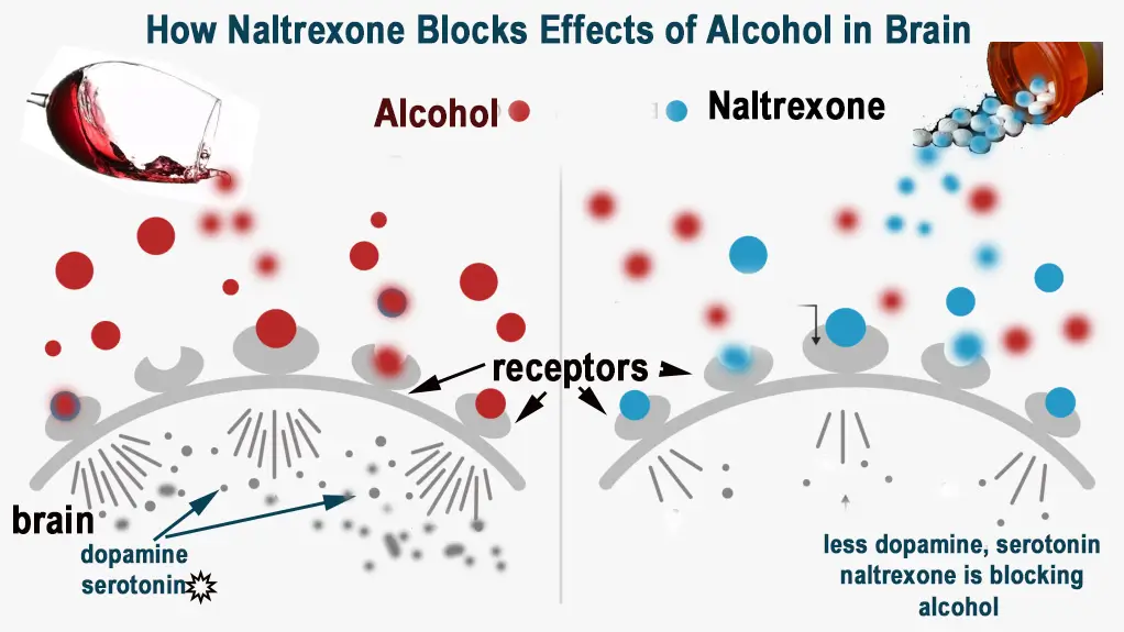 naltrexone effect