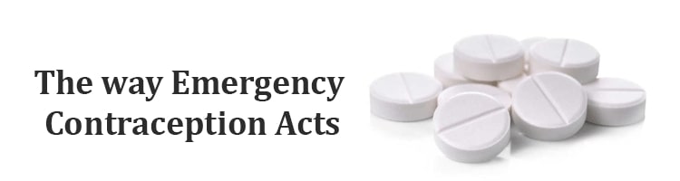 Emergency contrapaction act
