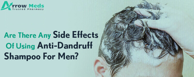 Are there any side effects of using anti-dandruff products?