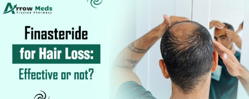 Finasteride for Hair Loss Effective or not