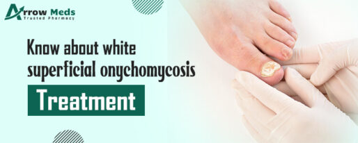 Know About White Superficial Onychomycosis Treatment Definition of White Superficial Onychomycosis White Superficial Onychomycosis is a type of fungal infection in the foot or foot fingers. It is a nail infection caused by several factors and a common type of nail infectious condition that can typically occur on your toe side, which makes your nails breakable, fragile, and stained nails. It is also called Onychomycosis, which is similar to almost an athlete’s foot. In spite of affecting your feet or even between your toes, it simply attacks your nails. However, such foot infection can spread all over your nails, making you feel awkward on every occasion. Even though fungi infections are very petite organisms, they can be seen through microscope devices. Various things cause such nail infections. Sometimes, they leave your skin nuisance, and it is infected with white-colored fungi yeast. It is a rare kind of fungus that occurs on your toenails, and it badly invades your nail area and also gets your toenails affected with other fungi infections. At that time, such particular fungus emerged as white spots and turned to be crumbly, which also caused toenails to disintegrate. Causes and Symptoms When foot infection cracks or brittle in your nails, sometimes it affects the skin of the nails and badly affects the fungi that develop inside the nails. As fungi infections become white and turn into a dark color inside the nails, at that time only, the inside fungus grows up and also affects your fingernails. The blood flow reduces in the fingernails of the toes, making it difficult to stop the infection. After that, the fungal nail infections are because of the: • If your nails are more fragile, that is almost to break down. • Weakening your immune health system, like you suffer from high blood sugar or diabetes. • Walking barefoot all around the places and overall places like swimming pools, showers, and other destinations. • Communicable fungal infection of other people. • Having athlete’s foot and the fungi infections spreads to other nails. • Wear plastic gloves, and most of the time, your hands and feet are wet. • Getting injured and leaving untreatable. Another main cause of white superficial Onychomycosis is the excessive use of different types of chemical components, including nail polish removers, which can damage your nails and cause dehydrated nails. Furthermore, most chemical compounds badly affect your nail. These chemical substances have keratin that makes your nails brittle and dehydrate. The symptoms of these foot fungal diseases are: • Painful • Thick • Cracked • Fragile • Brittle • Discolored Treatment Options There are various treatment options for white superficial Onychomycosis, and you should visit a doctor whenever you experience this nail infection disorder. And they are: Oral suspension antifungal: Oral antifungal is a medicine that your doctor prescribes you to take every day to eliminate fungi infections from the body. It is one of the most effective ways to overcome such nail fungi infections. This treatment will continue for 2 to 3 months but work successfully. Newsworthy antifungal: This is a treatment that dermatologists will recommend you use by rubbing the medications on your nails, and it is very helpful in killing infections inside the nails. Even so, they will go profoundly into the nail to treat this severe infection and just take it as a topical therapy, which is used as a fusion of medicine. Surgery: If no treatment works properly, then dermatologists always suggest surgery, and with this therapy, the nails will be removed completely from your skin and then allows them to re-grow into new one. Laser therapy: Dermatologists recommend innovative treatments that implement a unique type of light to eradicate the fungus from toenails. This way, nail infections are treated with a wide range of treatment options. Laser Therapy - Use of lasers to target and kill the fungus There is a great importance of laser therapy for the white superficial Onychomycosis that is also the best way to remove fungi infections from the entire nails. The area becomes whitish in the nails when the virus attacks, so, at that time, one of the primary treatments uses laser therapy, which mainly targets an infected part of the nail and starts its treatment. With such a laser process, the therapy can be used to provide a complete solution to killing all contagions. The contamination inside the nails can be cured with a laser process, where a special type of light is utilized to ward off infections in the fingernails. When other treatments fail to work for this nail viral infection, laser therapy effectively works with the fastest process to give a perfect nail infection treatment. Oral Antifungal Medications Using oral antifungal medications for white superficial Onychomycosis is a beneficial and healthy way to provide an effective curing solution for your infectious nails. In addition, at the first stage of such infectious diseases, the doctors always suggest you utilize antifungal drugs, which are helpful in providing the speediest process of preventing and healing infections. These oral medicines are recommended to be taken every day to kill infections from your nails, and it has instructions to use in the proper ways. Therefore, take such particular antifungal medicines, which will assist in giving you the right treatment options for brittle and fragile nails. Importance of Consultation Don’t ignore this infection of white superficial Onychomycosis and take it seriously because this problem can be double; that is why it is recommended to visit a dermatologist and consult with them. Consultation with doctors is most important because they will understand better than us and diagnose them with various other treatments when needed. Go to a specialist dermatologist for an effective treatment option for nail fungal infections immediately. Conclusion We find that white superficial Onychomycosis is a disease or condition that attacks your toenails and fingernails, so to prevent the symptoms of such nail infections, it is vital to keep in mind certain points to clean your fingernails and toenails. Do not avoid this problem, and it is better to contact a doctor to get rid of such fungal infections at the same time; once you are successful in maintaining your nail health, then there will be no infection growing in the nails, and consulting a doctor can easily help you to overcome this problem immediately.